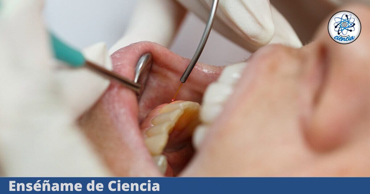 Las bacterias en la boca podrían vincularse con un mayor riesgo de cáncer de páncreas